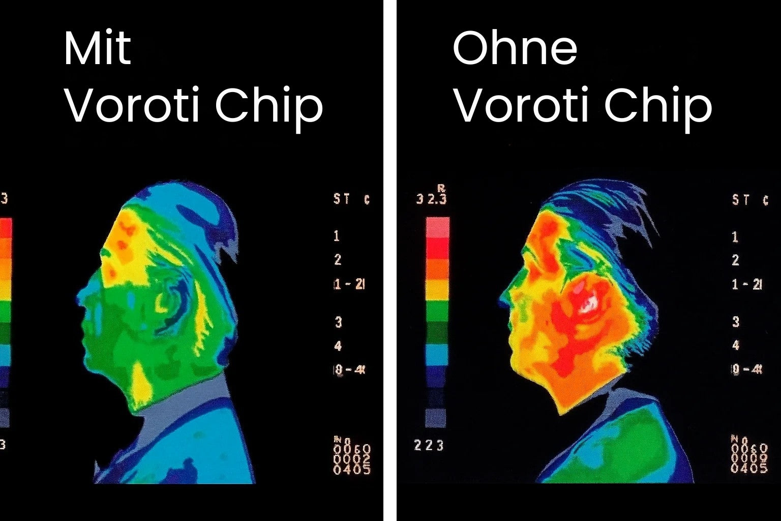 Voroti Chip